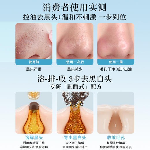 优选丨韩国ilso一苏黑头导出液150ml黑头水控油祛黑头粉刺温和无刺激 商品图1