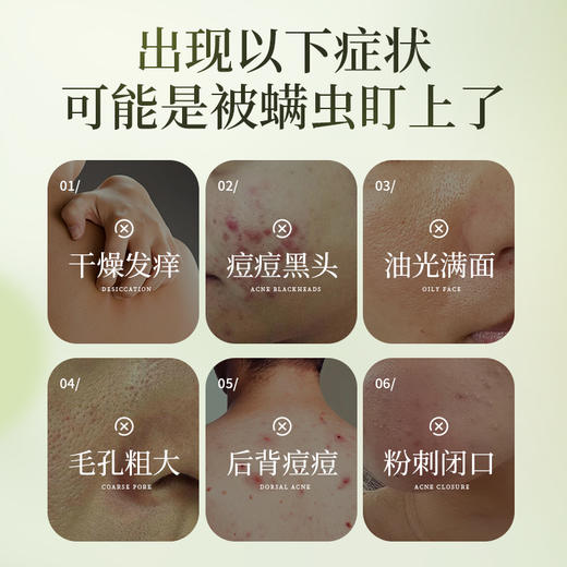 【梵西新品 119元任选3件】梵西人参金箔除螨皂控油清洁洗脸收缩毛孔手工全身除螨神器男女 100g/盒 商品图1