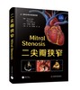 Mitral Stenosis二尖瓣狭窄 商品缩略图0