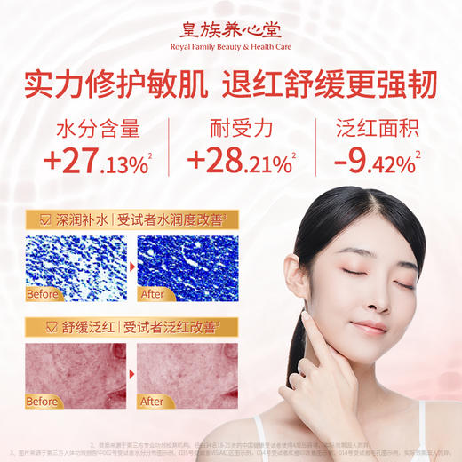 皇族养心堂平衡水爽肤水湿敷水大瓶湿敷400g舒缓修护控油祛痘无酒精 商品图1