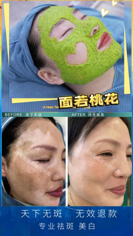 39.9元秒祛斑，专业祛斑、美白 商品图0