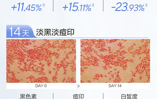【到手2件】欧诗漫珍白因水120ml，赠同款1瓶，到手2瓶正装 商品图3