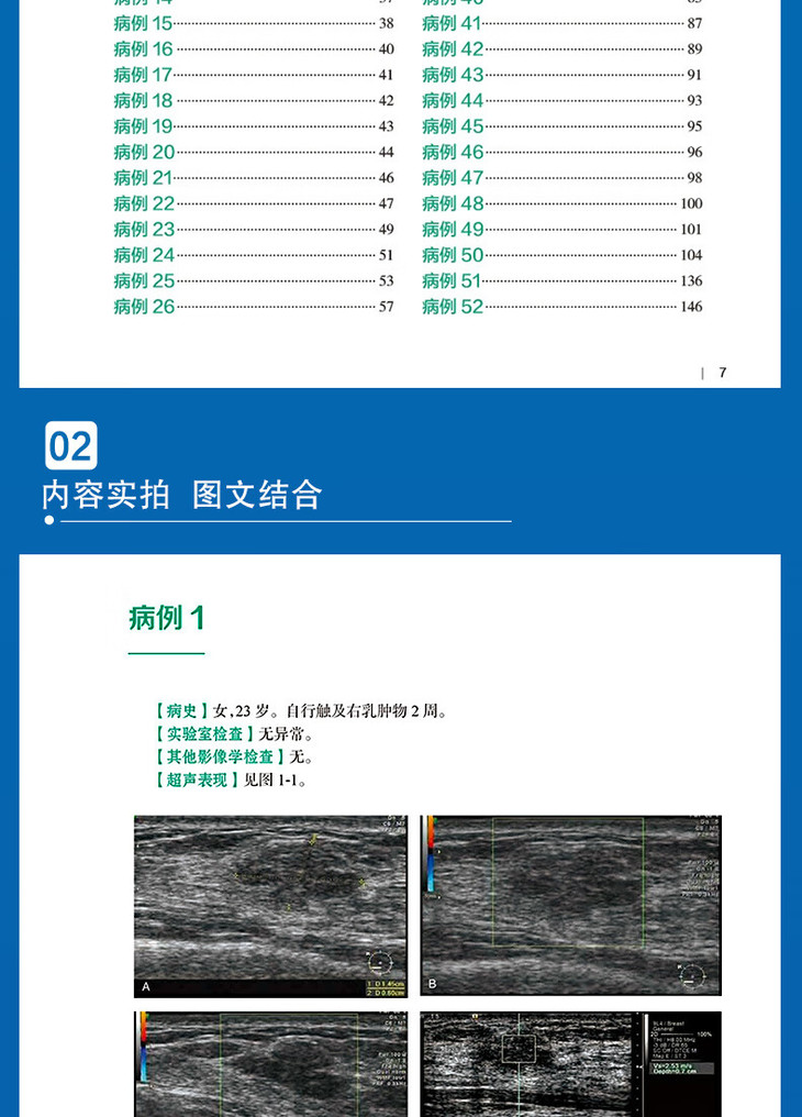 9787117340151乳腺疾病超声图解100例详情_10.jpg