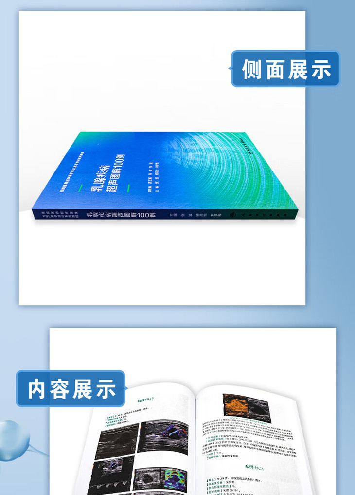 9787117340151乳腺疾病超声图解100例详情_07.jpg