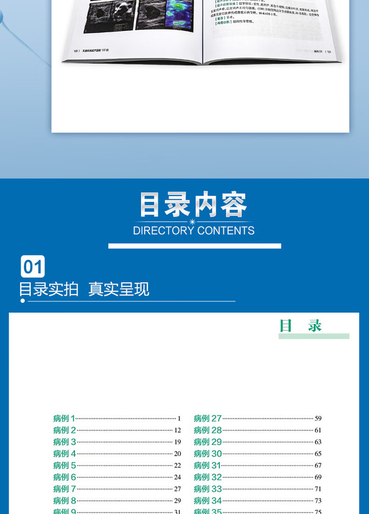 9787117340151乳腺疾病超声图解100例详情_08.jpg