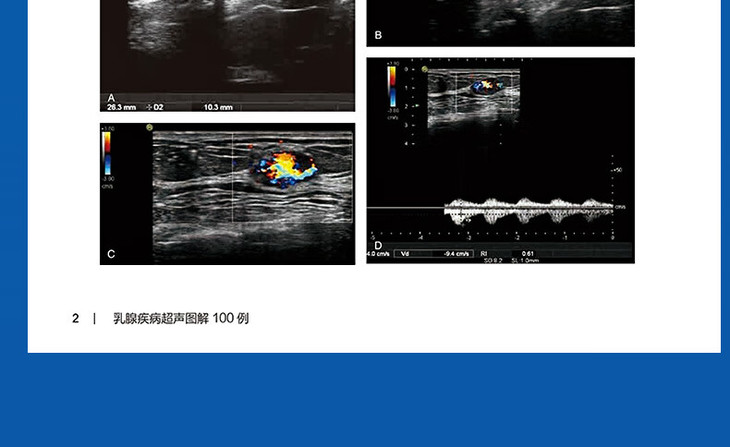 9787117340151乳腺疾病超声图解100例详情_12.jpg
