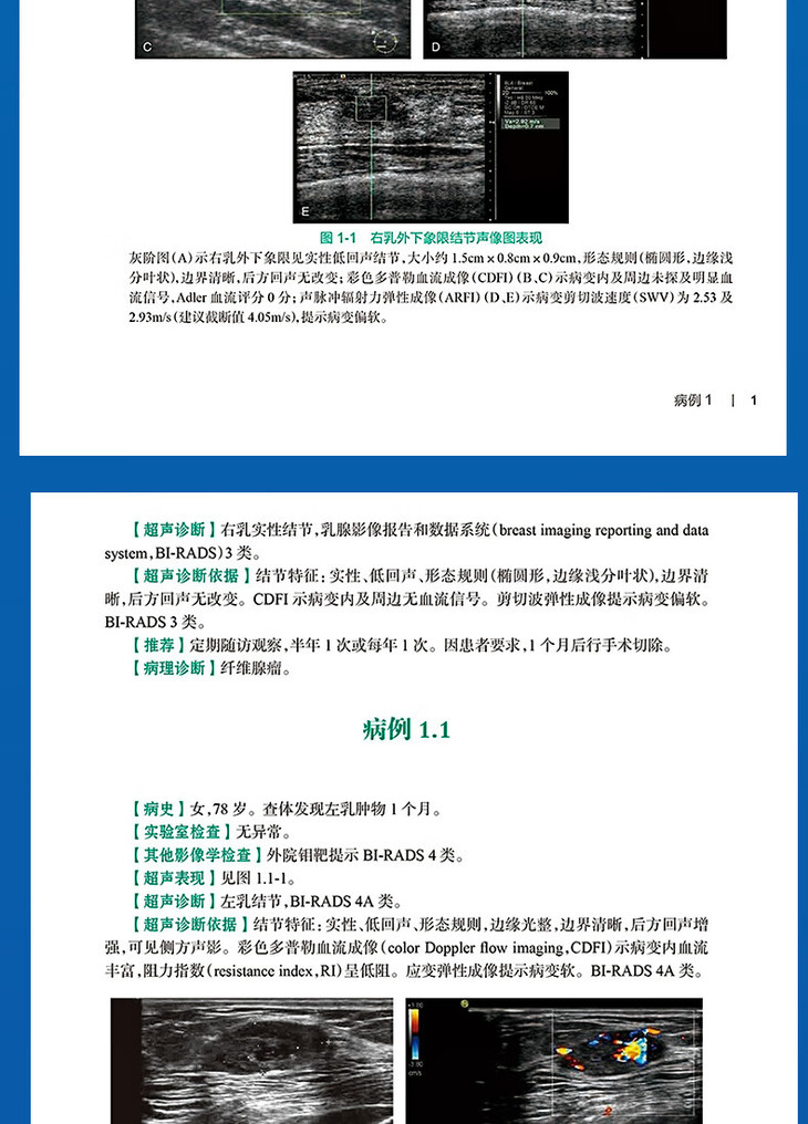 9787117340151乳腺疾病超声图解100例详情_11.jpg