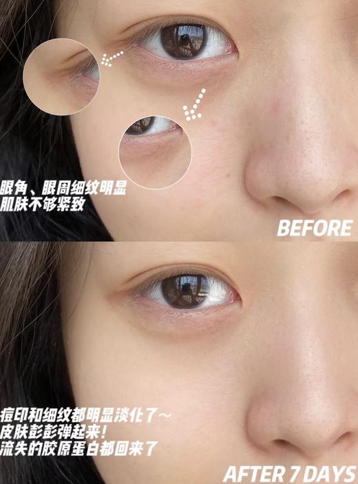 【2.28王炸割肉价】whoo后天气丹花献安瓶精华液8ml*6（限26年1月 无盒） 商品图3