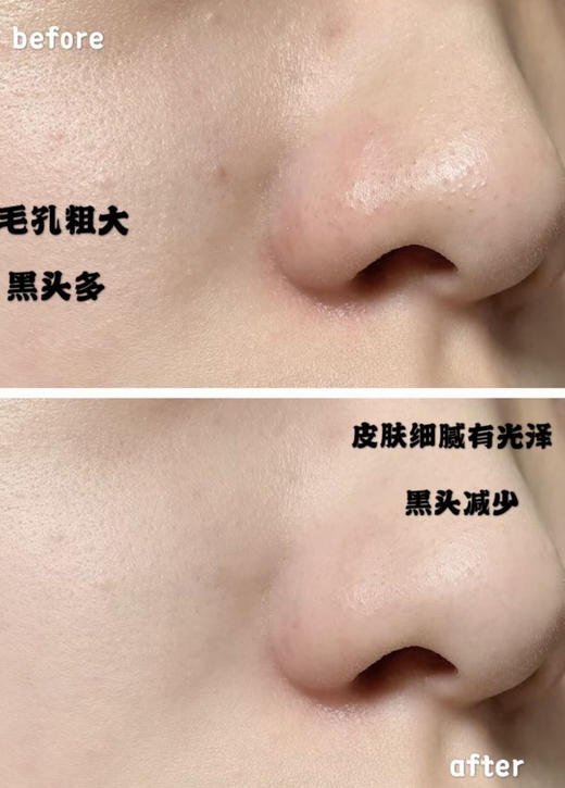 【8.11王炸割肉价】 IPSA茵芙莎粘土面膜100g（效期至24.10 国际五年到26年） 商品图4