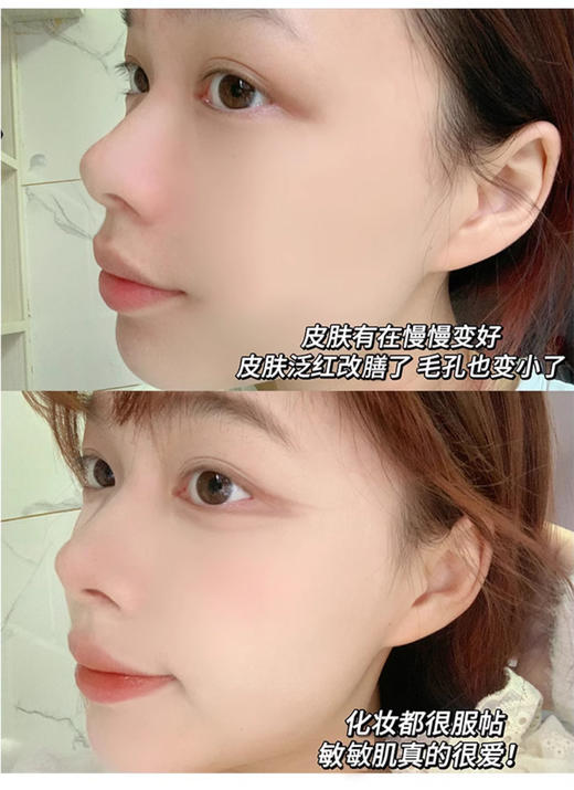 【清仓好价】REN/芢舒缓精华油30ml 商品图4