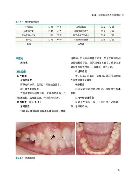 黏性骨块临床基础及应用 撒悦 李军 口腔科学书籍 黏性骨块临床应用病例解析 口腔骨缺损重建黏性 辽宁科学技术出版9787559133779 商品图3