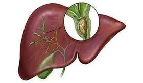 医生提醒：囊肿出现在3个地方，须留意