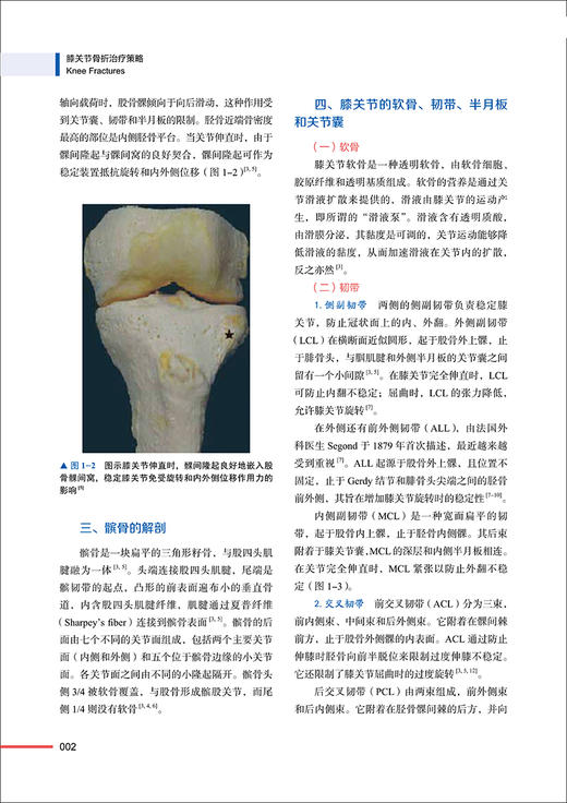 膝关节骨折治疗策略 王刚 主译 国际经典骨科学译著 膝关节影像评估解剖骨折手术术后康复 中国科学技术出版社 9787523606193 商品图3