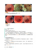 炎症性肠病相关肠癌内镜图谱 大肠与小肠的内镜检查图像 日松井敏幸 等著 虞伟明 许丰 译 辽宁科学技术出版社9787559134295  商品缩略图3