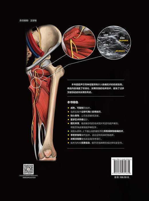 NYSORA神经阻滞手册 冯艺 主译 头颈部 上肢 下肢 躯干周围神经阻滞 神经阻滞彩色图谱 北京大学医学出版社9787565931635 商品图2