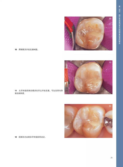 复合树脂修复的科学与技术 改订版 张泓灏 主译口腔牙齿种植修复学复合树脂充填技术前牙复杂病例树脂修复要点 9787559136626 商品图4