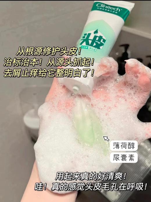 🤩哇塞‼️头皮也有“面膜”了💫比任何洗发水⻅效都要快又好‼️快和雪花说拜拜❄️头皮健康密码被它轻松拿捏了🤏【科丽尼头皮素】第四代来啦～ 商品图3