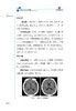 神经病学诊疗病例精粹一 中国医学临床百家 病例精解 神经系统变性疾病 主编吉训明 宋海庆 科学技术文献出版社9787523510353 商品缩略图4