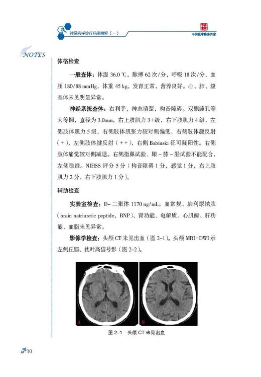 神经病学诊疗病例精粹一 中国医学临床百家 病例精解 神经系统变性疾病 主编吉训明 宋海庆 科学技术文献出版社9787523510353 商品图4