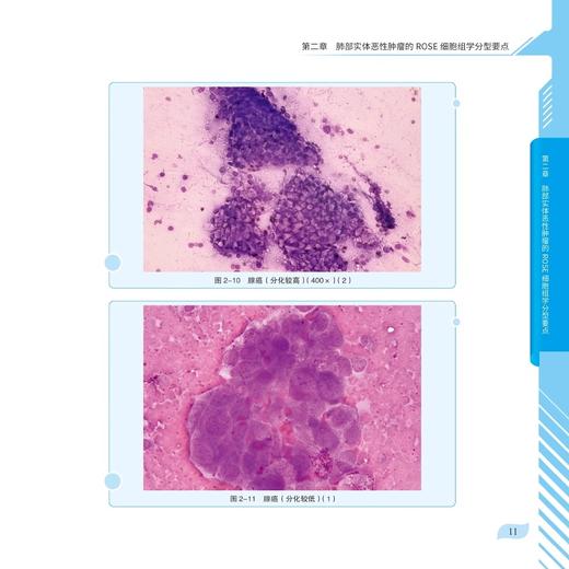 恶行肺脏疾病和肺脏少见病快速现场评价组学图谱 细胞及其成分径线增加 主编冯靖 靳芳 植丽佳 科学技术文献出版社9787523514702 商品图3