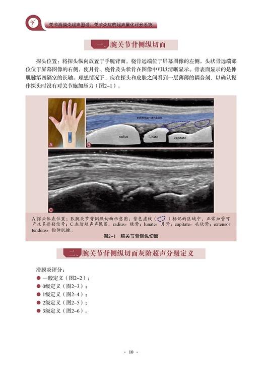 关节滑膜炎超声图谱 关节炎症的超声量化评分系统 滑膜炎灰阶超声评分规则 主译丁红 蔡叶华 科学技术文献出版社9787523514870 商品图3