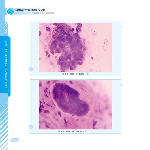 恶行肺脏疾病和肺脏少见病快速现场评价组学图谱 细胞及其成分径线增加 主编冯靖 靳芳 植丽佳 科学技术文献出版社9787523514702 商品图2