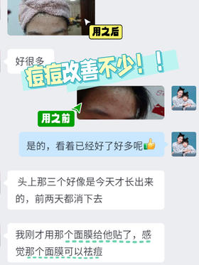 🌺粉丝真实反馈