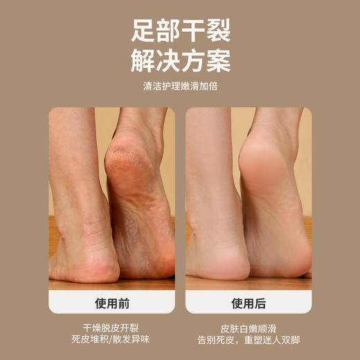 科迈升 电动磨脚器YM-P1 商品图2