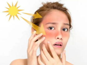 护肤课堂 | 夏季高温 警惕肌肤热损伤！