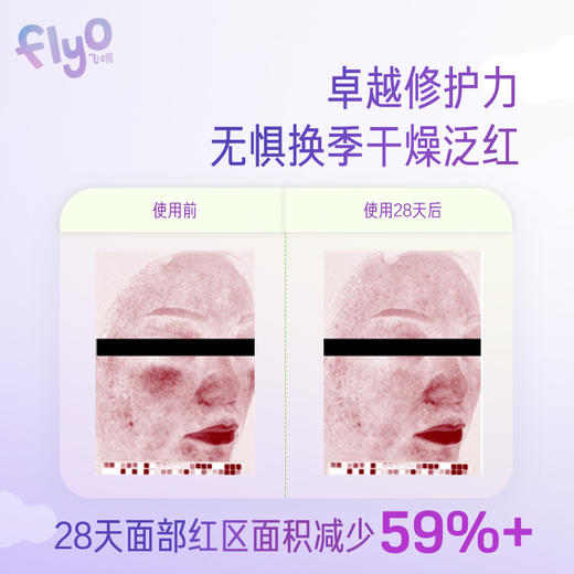 FlyO飞哦儿童面霜30ml+30ml替换芯 商品图3