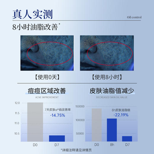 【买3送1】复因FOY祛痘控油平衡精华乳80g  收缩毛孔 积雪草舒缓泛红痘痘  控油 保湿  平衡水油 油痘肌 油敏肌**2件9折、3件8折 商品图7