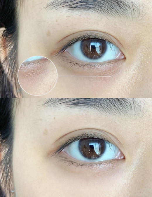 【8.18王炸割肉价】资生堂悦薇抗糖眼霜 15ml （限25年到期） 商品图5