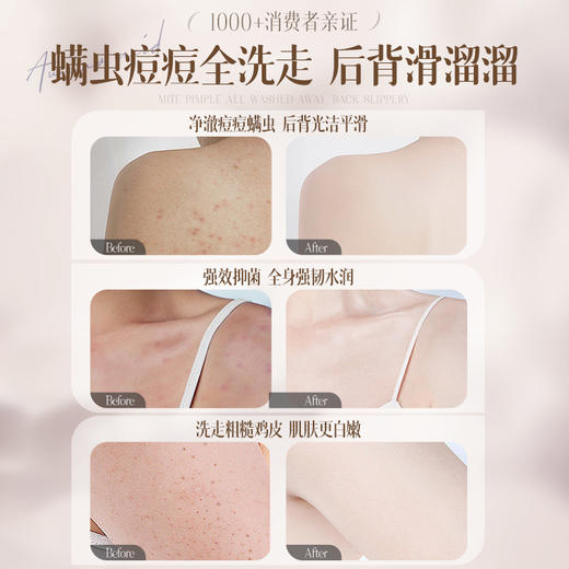 【🔥119选4件】再送面膜𝟏𝟐片  儒意硫磺舒肤洁净沐浴露500ml 除螨沐浴露皮肤后背祛痘祛鸡皮男女持久留香乳液|儒意官方旗舰店 商品图5