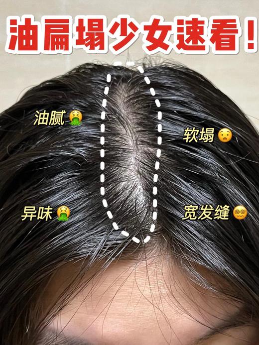 懒人的神❗️轻松实现3天不洗头的快乐》【Spēs诗裴丝控油蓬松免洗洗发水】告别油扁踏真的太太太nice！ 商品图3