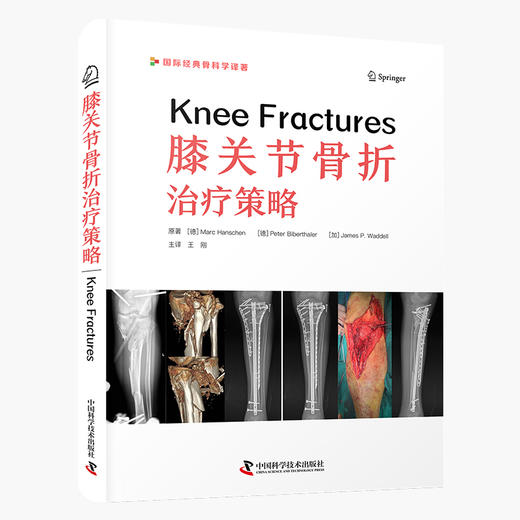 膝关节骨折治疗策略 商品图0