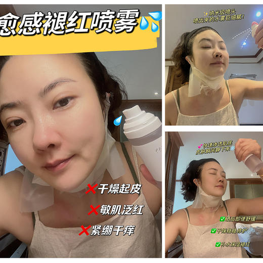 愈感舒敏修红喷雾100ml保湿补水精华舒缓修护敏感肌褪红爽肤喷雾 商品图1