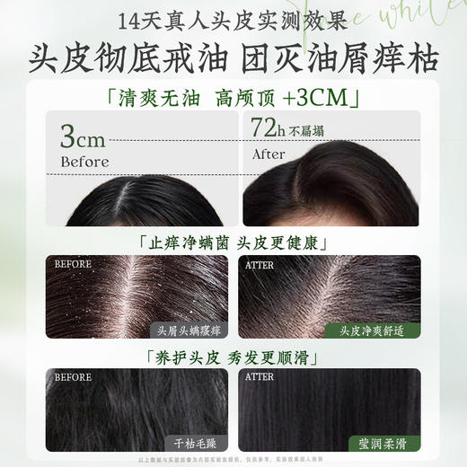 儒意油橄榄舒缓去屑洗发露500ml   控油蓬松去屑止痒除螨官方正品牌洗头膏露男女士|儒意官方商城 商品图3