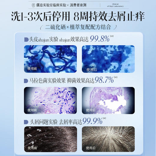 【🔥低至￥29.75/件|119选4件|9月超级会员日】儒意二硫化硒去屑蓬盈洗发水500ml 二硫化硒洗发水液控油蓬松去屑止痒头皮毛囊除螨官方正品洗头膏露|儒意官方旗舰店 商品图4