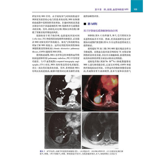 胸部影像问题解析 肺的正常解剖 影像学检查技术 基于解剖分区的疾病分类 胸部核医学成像 主编田树平人民卫生出版社9787117360876 商品图4