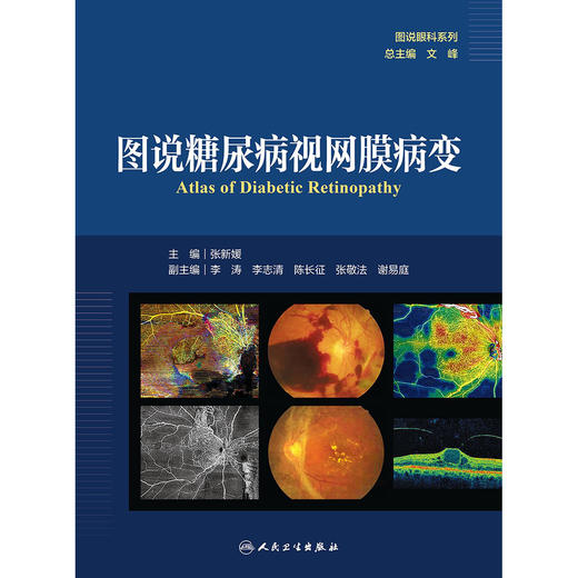 图说糖尿病视网膜病变（图说眼科系列） 2024年8月参考书 商品图1