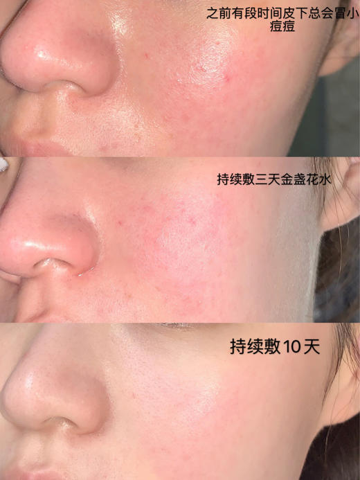 【8.25王炸割肉价】科颜氏金盏花爽肤水正装500ml （限24年12月） 商品图5