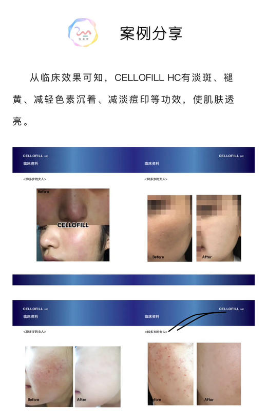 赛洛菲童颜水光三型胶原水光赛洛菲hc美白 商品图13