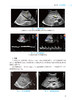 急诊超声分册 急诊医师核心能力建设系列教材 徐军 张秋彬 超声在各系统常见急诊疾病中床旁临床应用 人民卫生出版社9787117354806 商品缩略图3