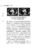 肺栓塞2023观点 警惕陷阱及早诊断 PTE概念及其危险分层的知道意义 防控结合三化统一 主编米玉红科学技术文献出版社9787518999507 商品缩略图4
