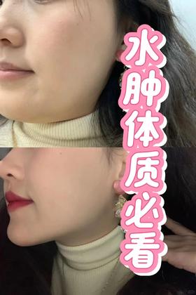 你到底是胖呢？还水肿湿气重！你能分的清吗？#水肿#清清饮