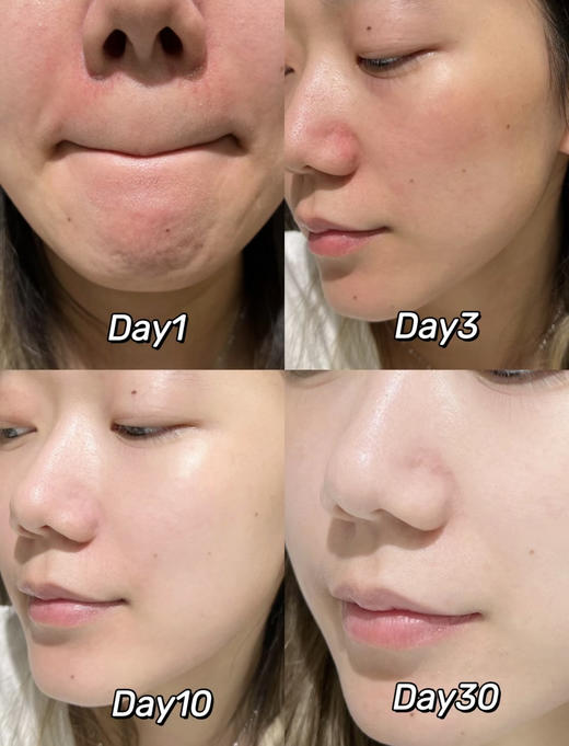 理肤泉B5 PRO面霜100ML 多效修复霜 5大强效修复成分 商品图7