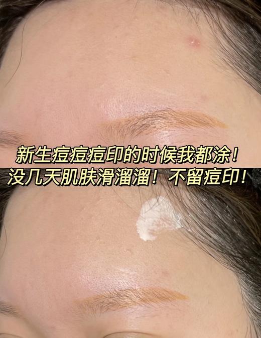 理肤泉B5 PRO面霜100ML 多效修复霜 5大强效修复成分 商品图5