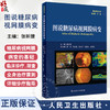 图说糖尿病视网膜病变 图说眼科系列 糖尿病与糖尿病眼部并发症 糖尿病视网膜病变的发病机制 张新媛 人民卫生出版社9787117358873 商品缩略图0