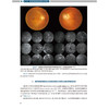 图说糖尿病视网膜病变 图说眼科系列 糖尿病与糖尿病眼部并发症 糖尿病视网膜病变的发病机制 张新媛 人民卫生出版社9787117358873 商品缩略图4
