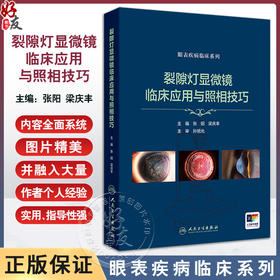 裂隙灯显微镜临床应用与照相技巧 眼表疾病临床系列 数码裂隙灯拍摄条件选择 镜面反射法 主编张阳等 人民卫生出版社9787117361095